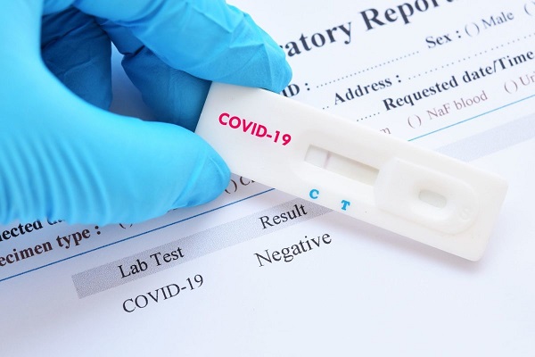 A Doctor Holding A Test Kit For COVID-19 Disease.